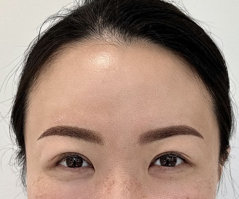 somibrow client immediately after microblading, day 1