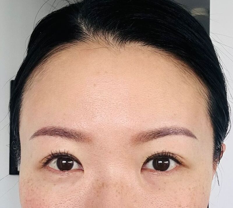 somibrow client after microblading, day 6