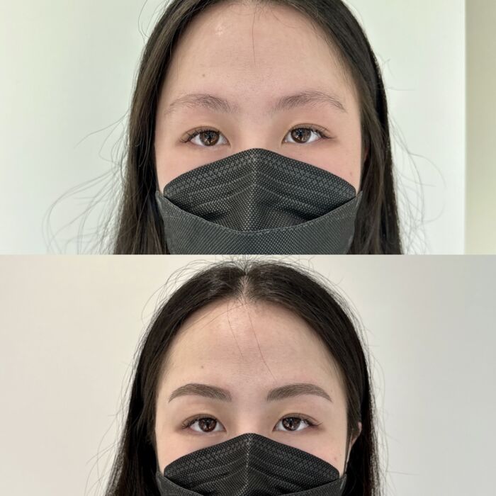 somibrow combo microblading and microshading girl1 before and after