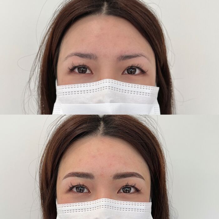 somibrow combo microblading and microshading girl2 after