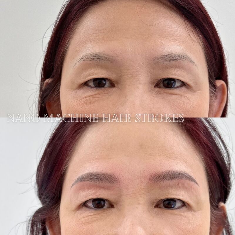 somibrow nano machine hair stroke brows girl2 before and after